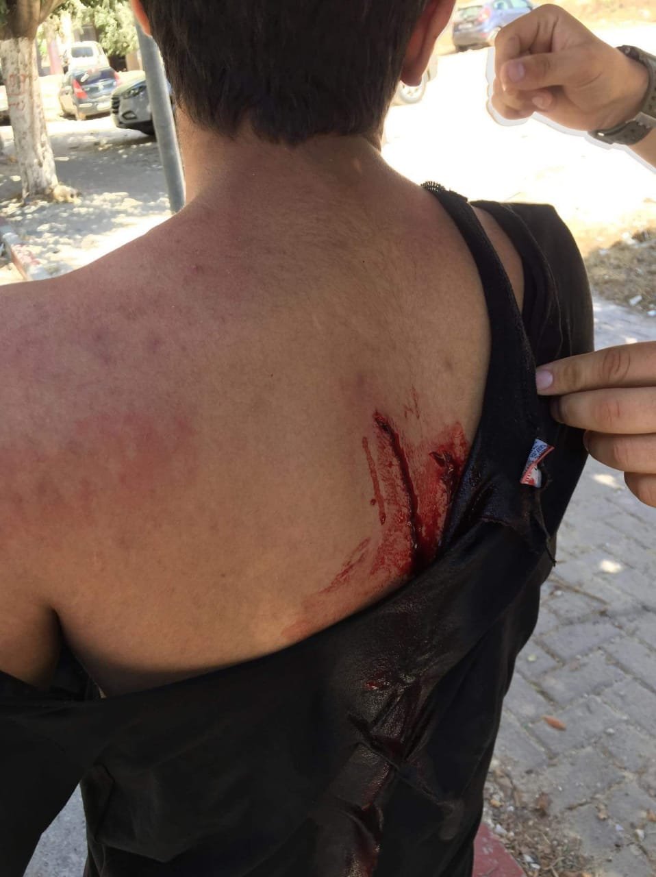 إصابات جراء شجار عنيف في جامعة النجاح بنابلس-2