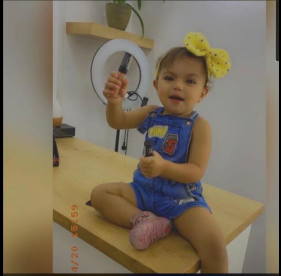 رهط: مصرع الطفلة غلا الجلاوي (عامين) اثر تعرضها للدهس-0
