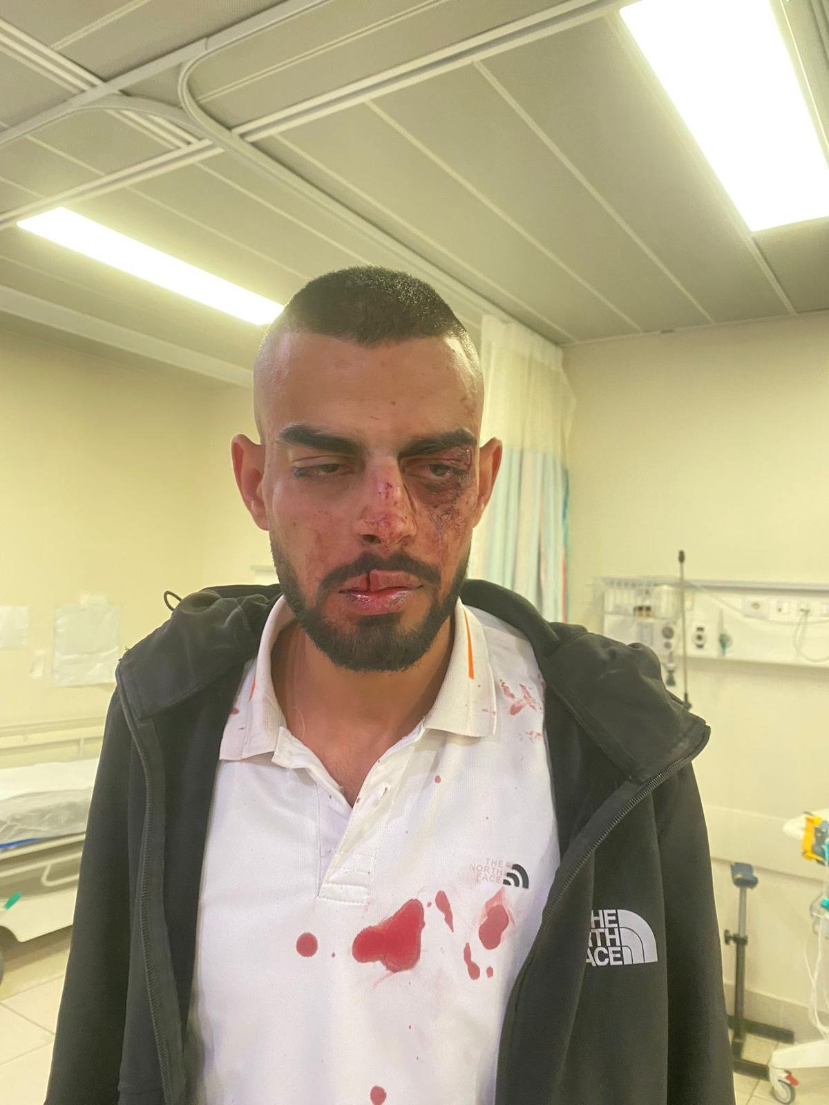 الشاب الفحماوي أحمد طميش: يرقد في المستشفى بعد ضرب مبرح دون سبب من جنود-0