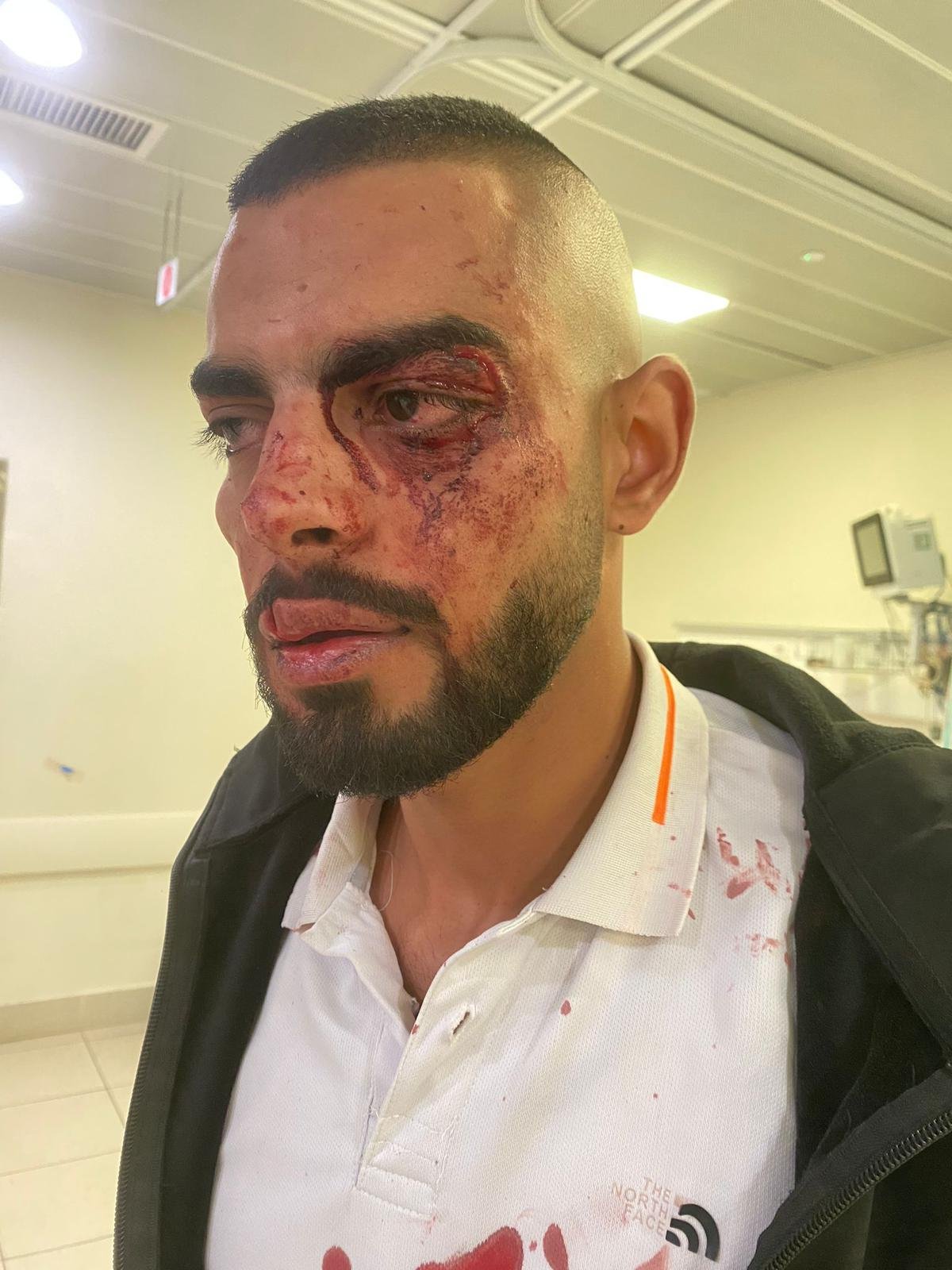 الشاب الفحماوي أحمد طميش: يرقد في المستشفى بعد ضرب مبرح دون سبب من جنود-3