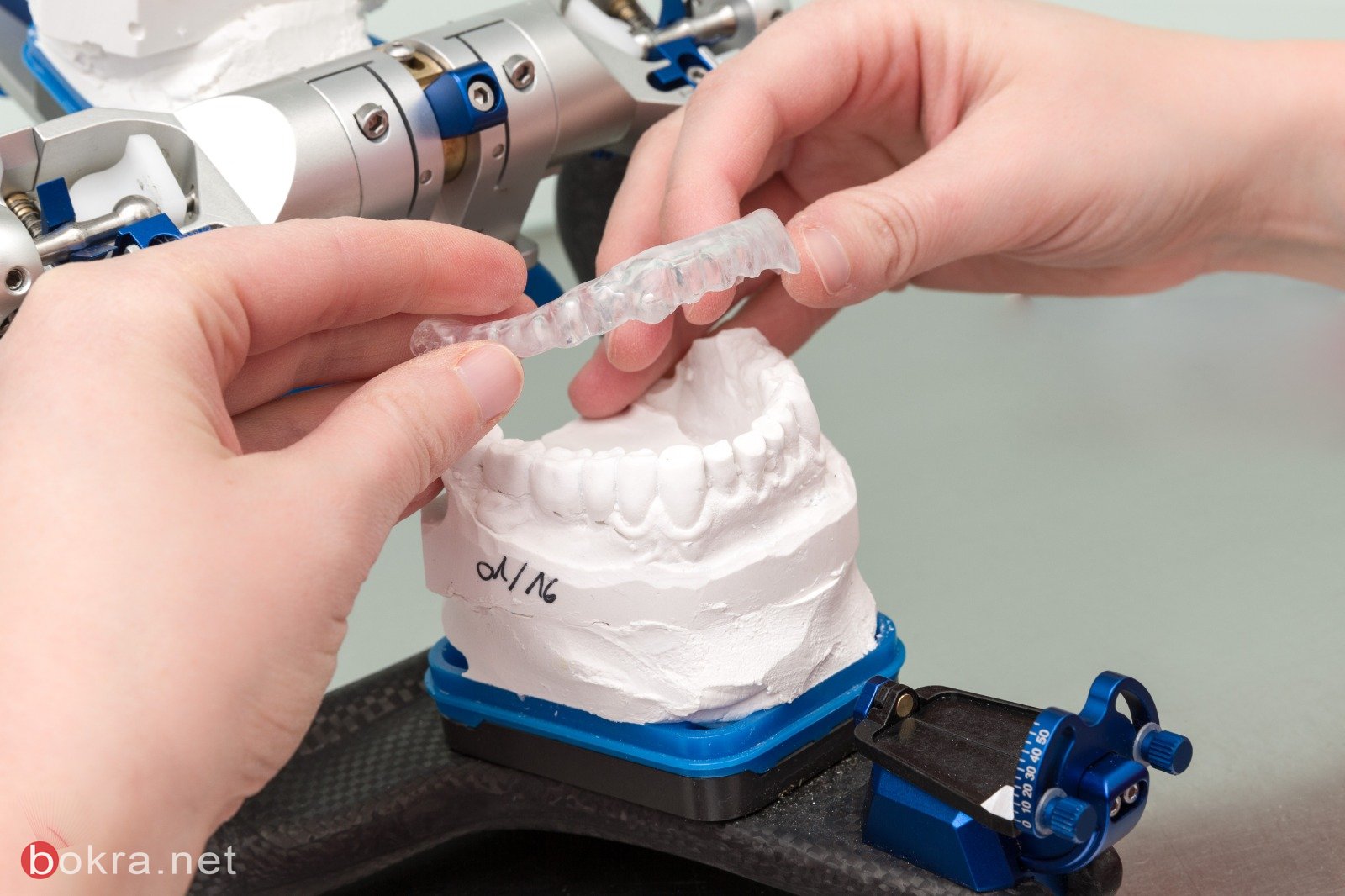 الطباعة ثلاثية الأبعاد تحدث ثورة في مجال طب الأسنان-2