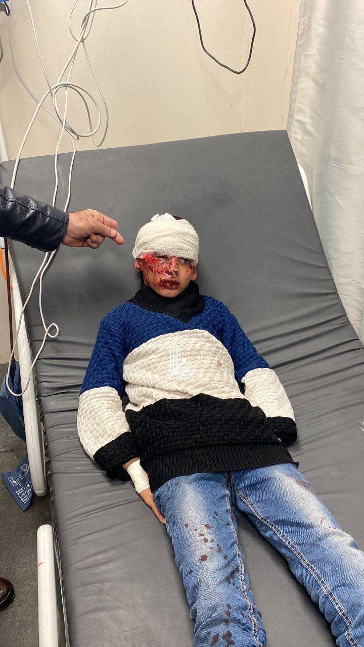إصابة الطفل يزن الرجبي باعتداء للمستوطنين في الخليل-0