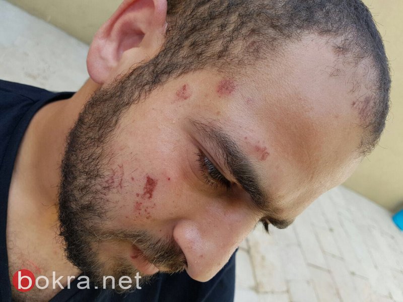 الطيبي يستجوب وزير الأمن الداخلي في أعقاب اعتداء أفراد الشرطة على محمد ناطور *-2