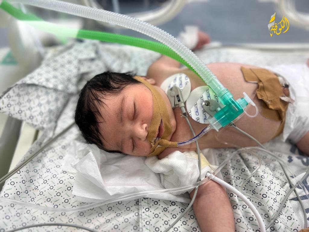 أطباء غزة ينقذون حياة الجنين مكة أبو شمالة من الموت داخل بطن أمها بعد استشهادها-5