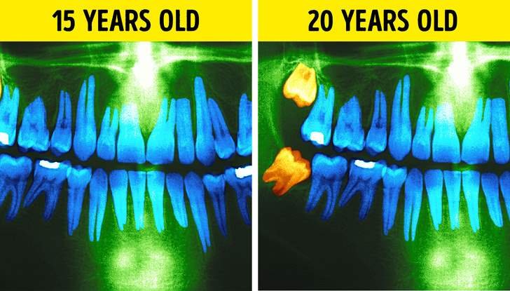 إليكِ التغيرات التي تحدث لجسمكِ كل 10 سنوات-3
