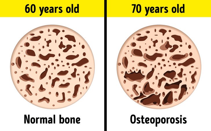 إليكِ التغيرات التي تحدث لجسمكِ كل 10 سنوات-4