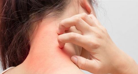 سرطان الجلد... كيف يمكن الوقاية منه؟