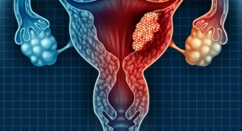 تقرير جديد يعزز فعالية لقاح فيروس الورم الحليمي البشري (HPV) في الوقاية من سرطان عنق الرحم