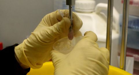 وزارة الصحة الإسرائيلية تحذر: مصابان بالحصبة استخدما المواصلات العامة