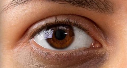 الهالات السوداء تحت العينين قد تشير الى اصابتكم ببعض الأمراض