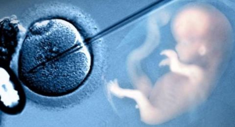 ما حكم إجراء عملية حقن مجهري لتحديد نوع الجنين؟.. الإفتاء تجيب