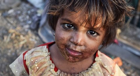 دراسة تكشف تأثير الطفولة القاسية على الدماغ