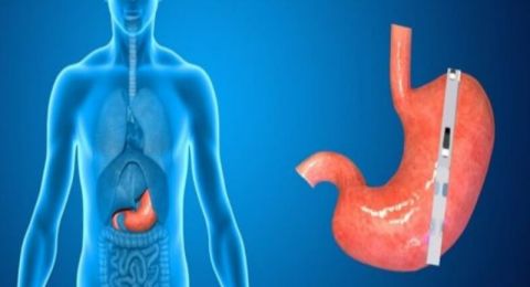 أطعمة يمكن أن تهيج بطانة المعدة