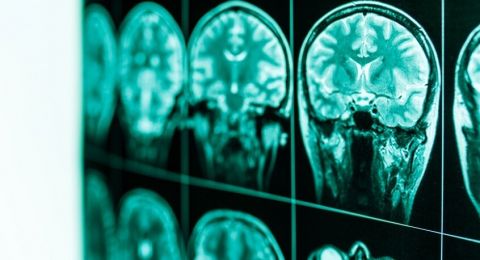 دراسة توضح تأثير الكحول على مناطق اتخاذ القرارات في الدماغ