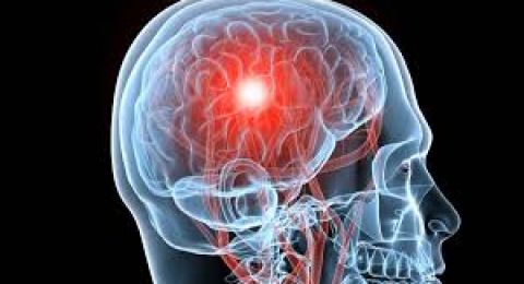 تغير في السلوك لدى الشباب قد يكون جرس إنذار لمرض دماغي خطير
