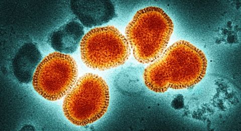 استراليا.. علماء يكتشفون فيروسا خطيرا جديدا