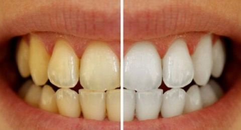 أعراض بسيطة لكنها خطيرة.. متى يجب مراجعة أخصائي تقويم الأسنان؟