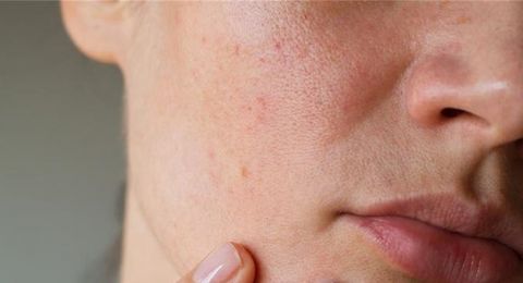 تحذير للنساء من عادة تجميلية قد تسبّب تلفاً في البشرة