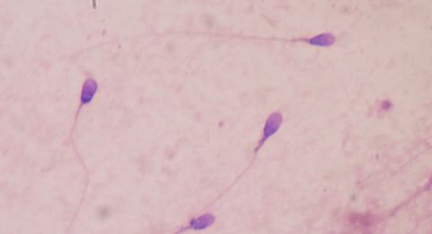 دراسة: جودة السائل المنوي قد تؤثر على متوسط عمر الرجال