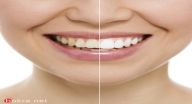 أطعمة طبيعية لابتسامة أطعمة طبيعية لابتسامة