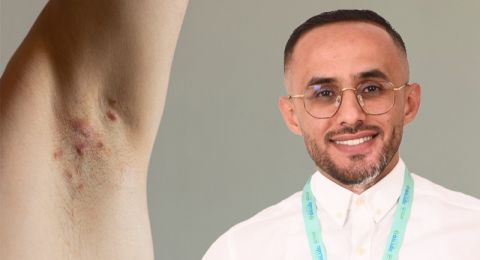 المرض الصامت الذي يغيّر حياة المرضى في المجتمع العربي..د. فراس العبرة في حديث لبكرا