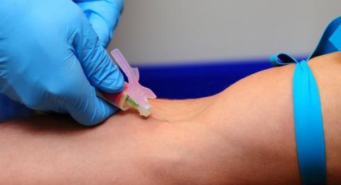 أمل جديد للنساء.. فحص دم مبكر يرصد سرطان المبيض بدقة