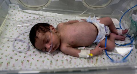 الأونروا: أطفال غزة يعيشون ظروفًا مزرية والمساعدات عالقة بسبب قيود على إدخالها