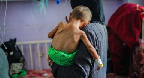 بين البرد والمرض… أطفال غزة في مواجهة يومية مع الجوع وانهيار الرعاية الصحية