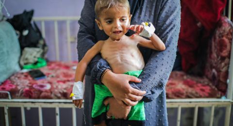 وزارة الصحة في غزة: ارتفاع وفيات سوء التغذية بين الأطفال