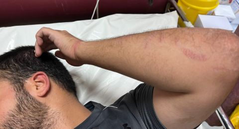 الجيش الإسرائيلي يعتدي على الصحافي حمزة حمدان أثناء تغطيته موسم قطف الزيتون شرق طولكرم