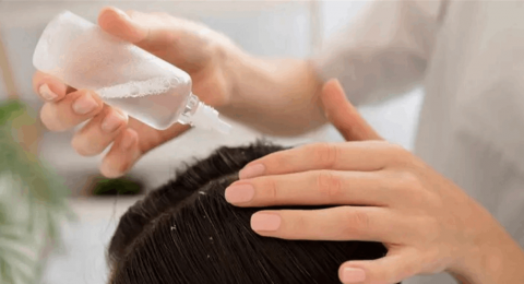 حمض الساليسيليك.. علاج فعال لقشرة الشعر