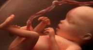 تأجيل قطع الحبل السري له فوائد صحية للأطفال تأجيل قطع الحبل السري له فوائد صحية للأطفال