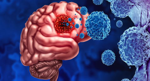 اكتشاف عامل خطر لأورام الدماغ يحيط بنا
