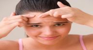 مشكلة حب الشباب وعلاجها