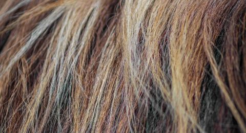 طبيبة تكشف عن مكون بسيط يعالج مشكلات فروة الرأس