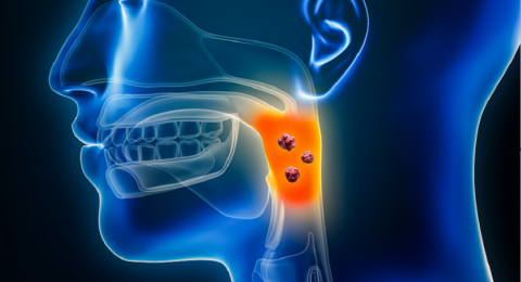 مشروبات شائعة الاستهلاك قد تسبب سرطان الفم القاتل
