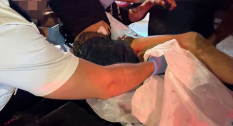 إصابة شاب بجروح متوسطة في حادث عنف في الطيبة