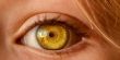 علامة "غريبة" في العين قد تكون مؤشرا لسرطان خطير