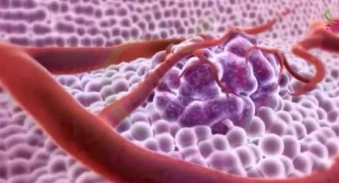 اكتشاف آلية خفية تحفّز نمو سرطان نادر وخطير