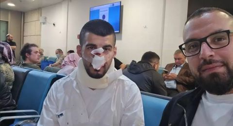 تصاعد الاعتداءات على سائقي الحافلات في إسرائيل: معظم الضحايا من السائقين العرب