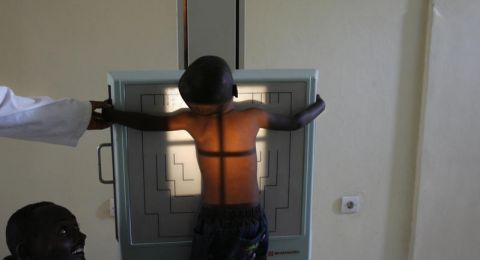 اختراق طبي في علاج سرطان الرئة في إسرائيل: استجابة لدى 37% من المرضى حتى في الحالات المتقدّمة