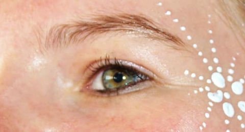 هل يمكن أن يكون فرط التصبغ علامة على شيء خطير؟