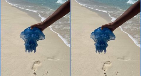 إصابة طفل إسرائيلي بلسعة قنديل بحر خطير في الفلبين وحالته حرجة