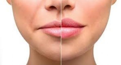 أفضل 5 وصفات منزلية لتقشير الشفاه، سهلة التحضير وموجودة غالبًا في كل بيت: