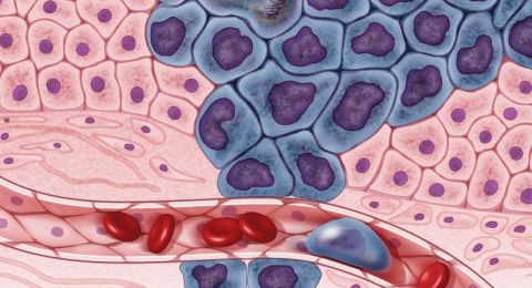 طبيب يحذر من 3 أطعمة شائعة ترتبط بزيادة خطر السرطان