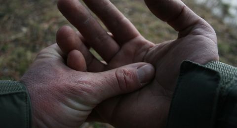 تحذير من أعراض برودة اليدين