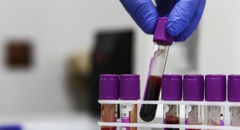 عالم أمريكي يفجر مفاجأة كبرى عن منشأ كورونا ويحدد دولة عظمى صدرت الفيروس للعالم