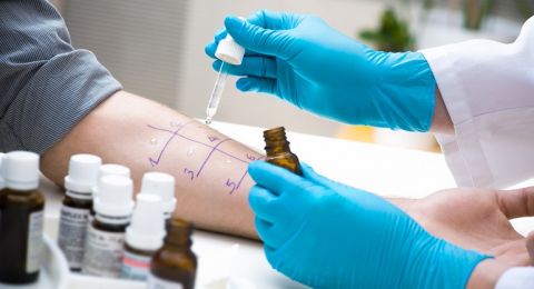 نقص حاد في أطباء الحساسية يفاقم أزمة المرضى في البلاد