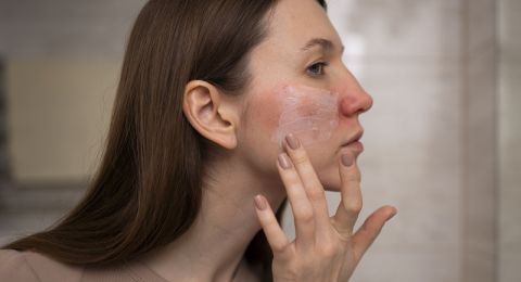 جفاف البشرة المفاجئ.. تعرفي إلى الأسباب وطرق الوقاية