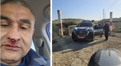 اتهام شاب يهودي بالاعتداء على الطبيب د. محمد مصالحة من كفر قرع بدافع عنصري